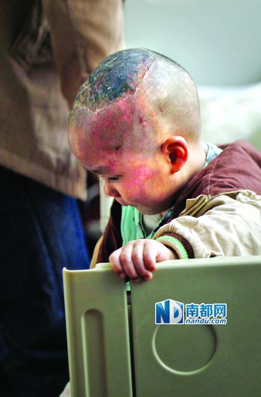 1月8日下午，小寶頭上和臉上都是傷痕。