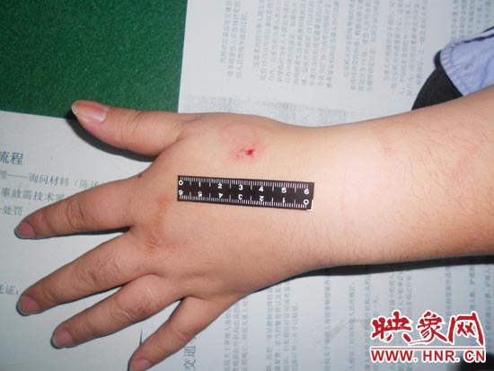 為幫助無證駕駛的朋友逃避處罰，新鄉的王某竟對執勤民警大打出手，還將一名民警的手臂咬傷
