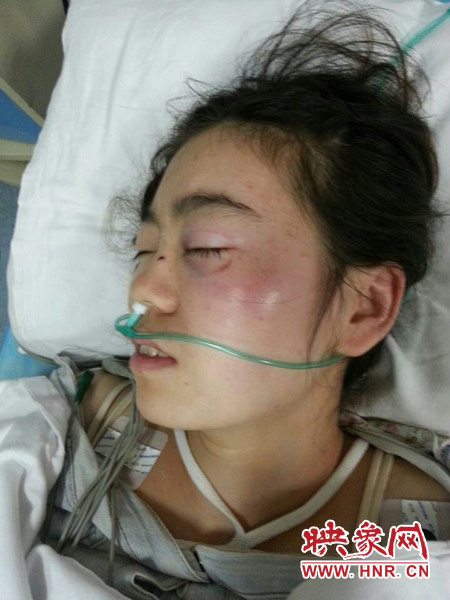 9月10日晚,被暴打的小陳出現(xiàn)了間歇性昏迷,被送進了省人民醫(yī)院。