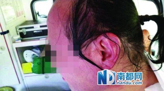 涉事教師遭熱水潑臉后的照片。