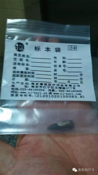 經(jīng)警方鑒定，秦女士體內取出的子彈系56式步槍射出 。 受訪者供圖