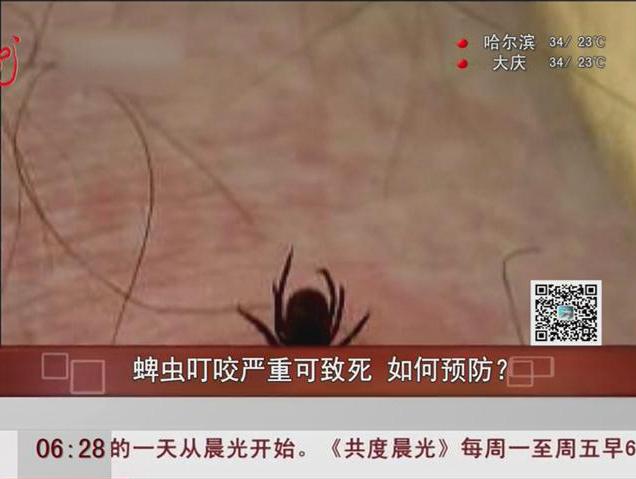 蜱蟲叮咬嚴重可致死如何預防？